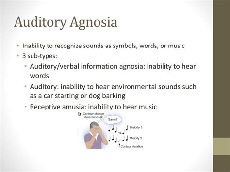 Agnosia Latest Facts: Definition, Types, Causes And, 52% OFF