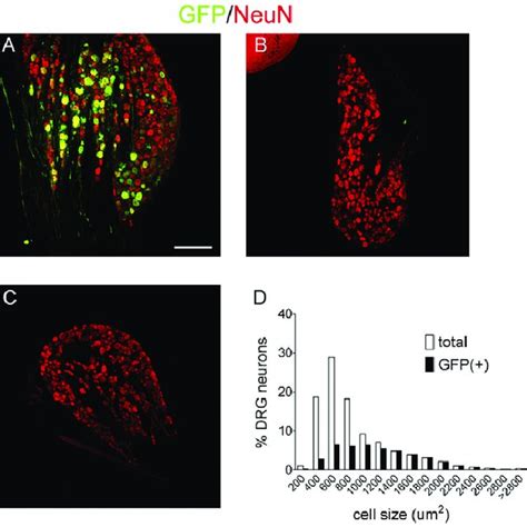 Expression Of GFP In Different Populations Of Neurons In The Lumbar