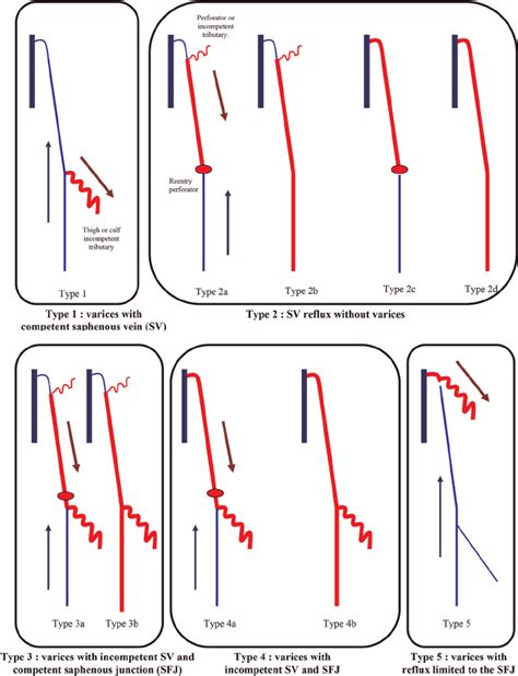 Duplex ultrasound scan typology | Download Scientific Diagram