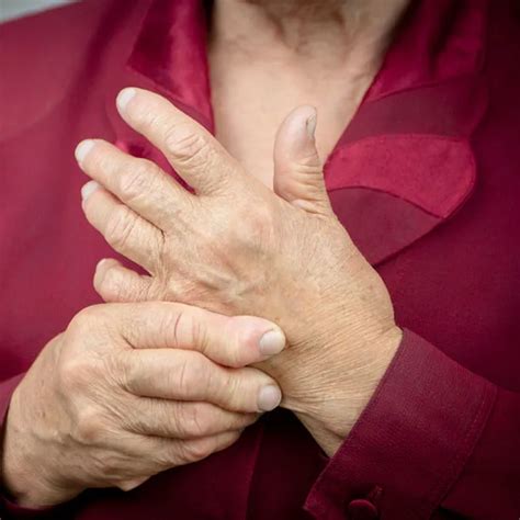 Rashes From Rheumatoid Arthritis Symptoms Causes Treatment