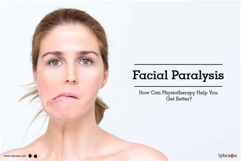 Facial Paralysis How Can Physiotherapy Help You Get Better By Dr