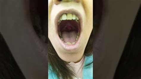 Badabaah Uvulalala Girl What Does Your Uvula Do Dangly Thing In Back