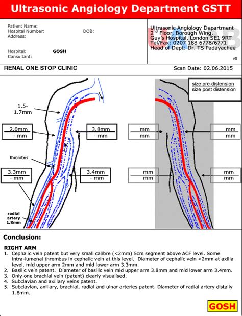 A Typical Mapping Diagram Showing Ultrasound Measurements Of The Arm