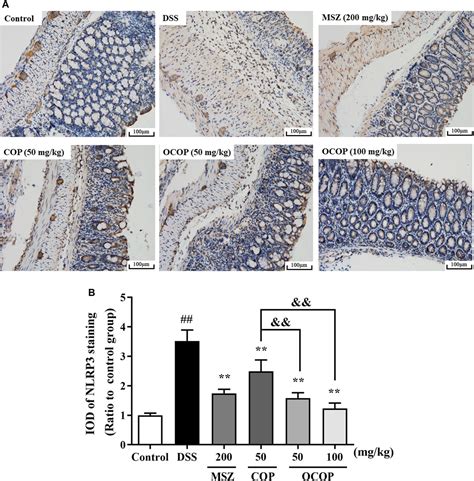 Frontiers Gut Microbiota Mediated Transformation Of Coptisine Into A