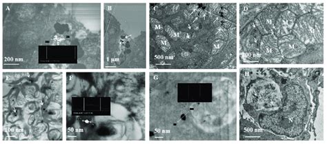 Biodistribution Of AuNPs In A Murine Model After Injection Of 108 NPs