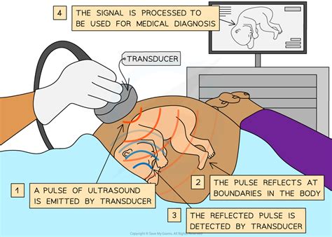 Ultrasound IGCSE Physics Revision Notes