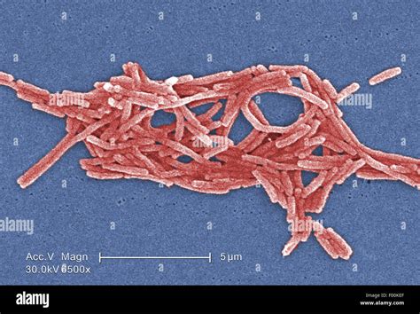 Colorized Scanning Electron Micrograph Sem Depicted A Grouping Of