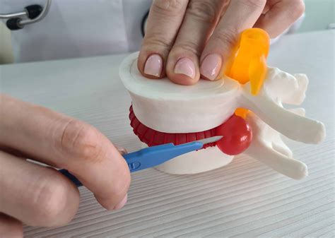 Cirurgia na Coluna: tipos, riscos, indicações, pós-operatório - ITC