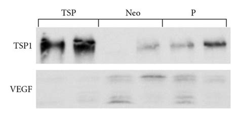 Characterization Of Thrombospondin Transfected U Thrombospondin