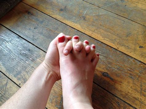 The Best Exercises To Straighten A Hammer Toe Hammer Toe Achy Feet Toe