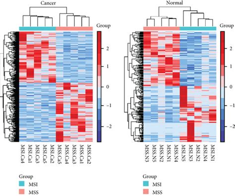 Identification Of Dmmr Msi Related Genes Between Cancer And Normal Crc