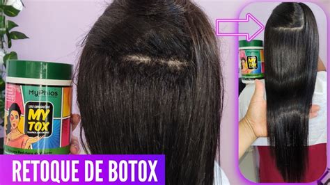 Como Fazer Retoque De Botox Usando O Mytox Da Myphios ApÓs 2 Meses De Progressiva Youtube