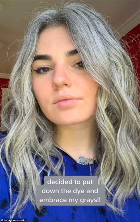 Woman 25 Whose Hair Started Turning Grey When She Was Just Nine