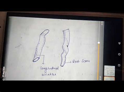 Pharmacognosy Of Rauwolfia Root Rauwolfia Serpentina YouTube