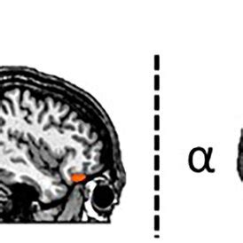 Cue And Movementlocked Oscillatory Activity During Target Processing