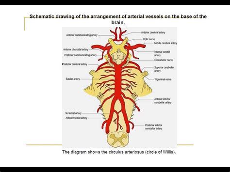 Posterior circulation stroke Syndromes