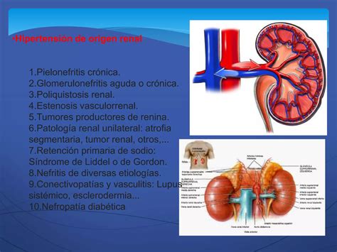 Tipos De Hipertension PPT