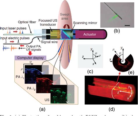 Figure From Ultrasound Guided Photoacoustic Imaging Current State