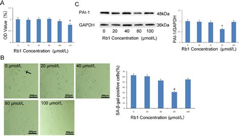 Ginsenoside Rb Prevents Age Related Endothelial Senescence By