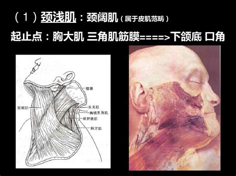 颈部肌肉解剖word文档在线阅读与下载无忧文档