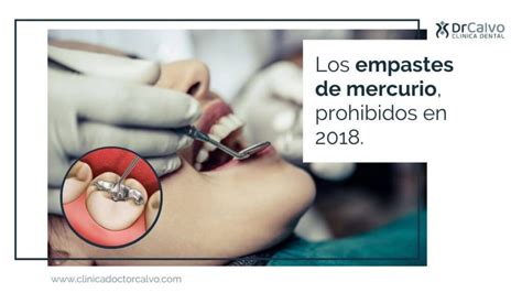 Los Empastes De Mercurio Prohibidos En Cl Nica Doctor Calvo