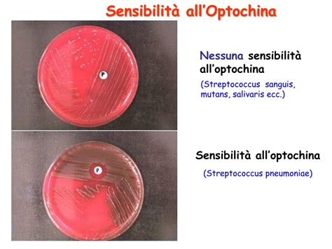 PPT - Streptococchi PowerPoint Presentation, free download - ID:5786879