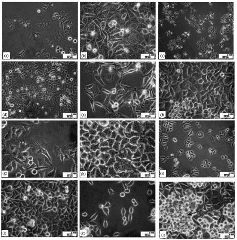 Hela S3 Cell Growth Conditions In Serum Free Medium And Adaptability