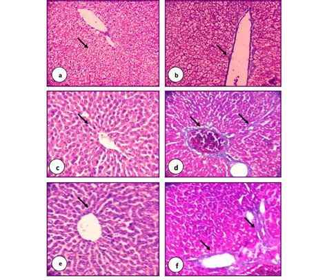 Photomicrographs Of Hande And Massons Trichrome Stained Liver Sections Download Scientific