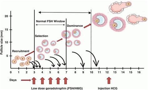 Ovarian Stimulation In Iui Obgyn Key