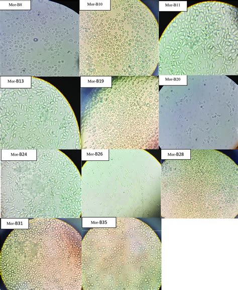 Morphology Of Different Yeast Isolates Download Scientific Diagram