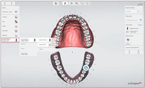 Guided Implant Surgery 3shape Communicate Workflow For Guided Surgery