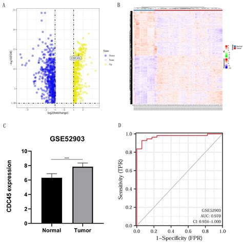 Expression And Prognosis Of Cdc In Cervical Cancer Based On The Geo