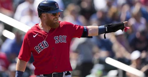 Red Sox Infielder Justin Turner Hit In Face By Pitch