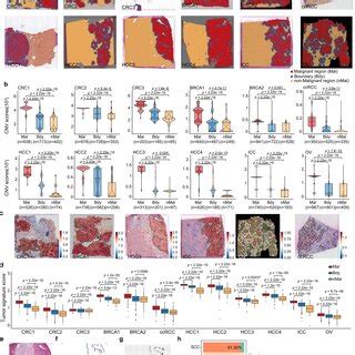 The Delineation Of Tumor Boundary In Multiples Cancers A Tissue Slides