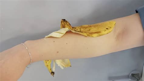 Inaspettato Il Motivo Per Cui Dovresti Strofinare 1 Buccia Di Banana