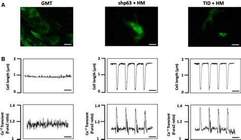 Functional Efficacy Of Human Cardiac Fibroblast Reprograming After