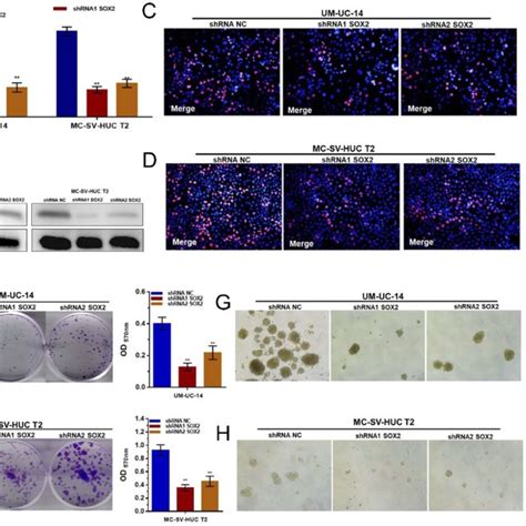 Effect Of SOX2 On The Migration And Invasion Of UTUC Cells A And B