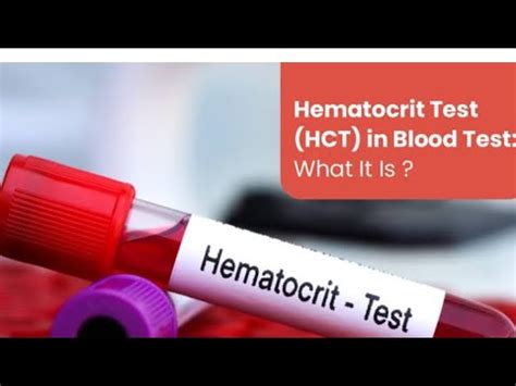 Hct Hematocrit Pcv Packed Cell Volume Cbc Complete Blood