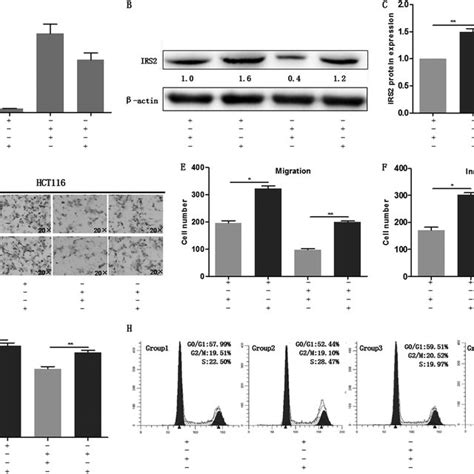 Mir 30a Suppressed Colon Cancer Cell Proliferation And Migration