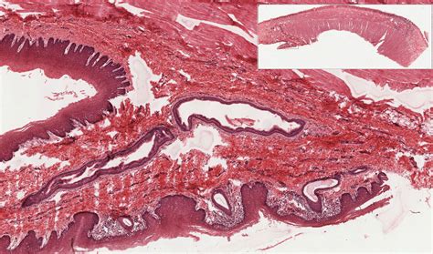 Oral Cavity Pharynx Esophagus And Stomach Histology