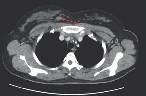 Contrast-enhanced chest CT imaging. Contrast-enhanced chest CT imaging ...