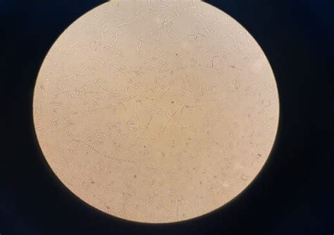 Microscopic Appearance Of Geotrichum Sp Download Scientific Diagram
