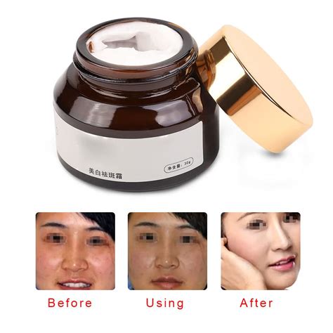 Buy Dark Spot Corrector Remover Skin Lightening Bleaching Cream