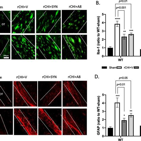 GPR110 Dependent Amelioration Of RCHIMERA Induced Glia Cell Activation