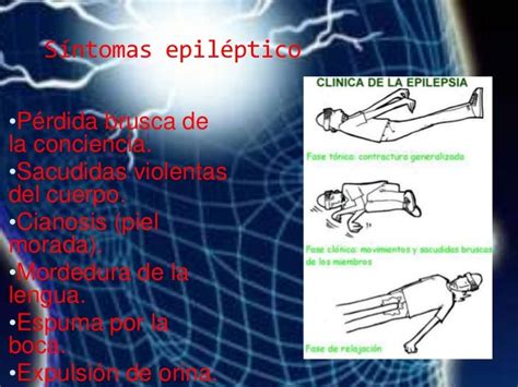 Primeros Auxilios Ataque Epileptico