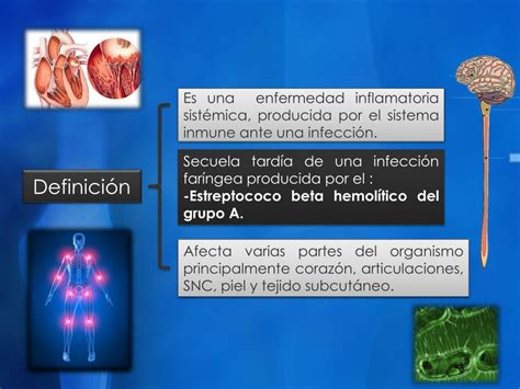 PPT Fiebre reumática PowerPoint Presentation free download ID 2329128