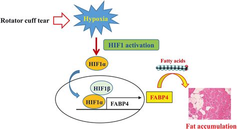 Fatty Acid‐binding Protein 4 Regulates Fatty Infiltration After Rotator