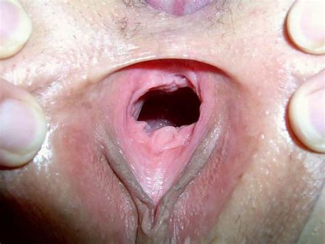 Very Extremely Gaping Pussies Porn Pictures Xxx Photos Sex Images Pictoa