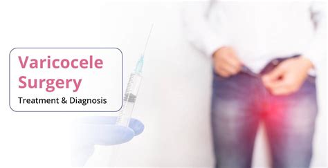Varicocele Treatment Management Medical Therapy