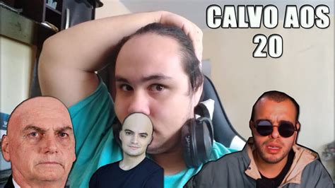 EU NÃO ESTOU FICANDO CALVO AOS 20 YouTube